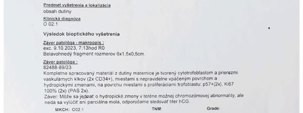 Výsledky histológie po potrate: Čo znamenajú?