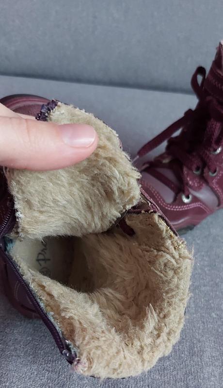 Zimné čižmičky, protetika,20