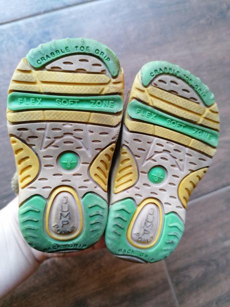 Sandálky, protetika,19