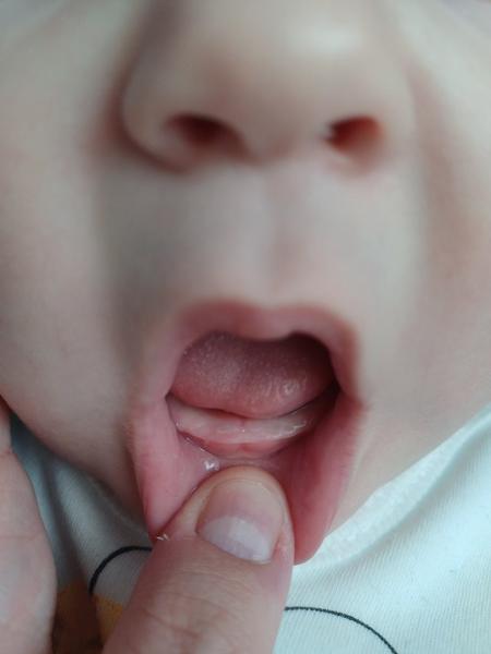 Ide nám už prvý zub?