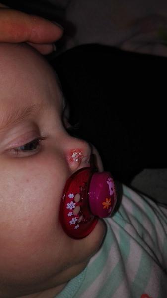 Aký kožný problém je toto?