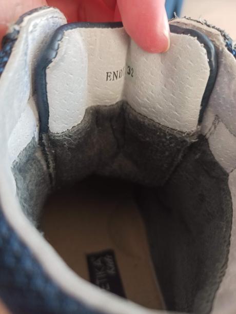 Topanky protetika, protetika,32