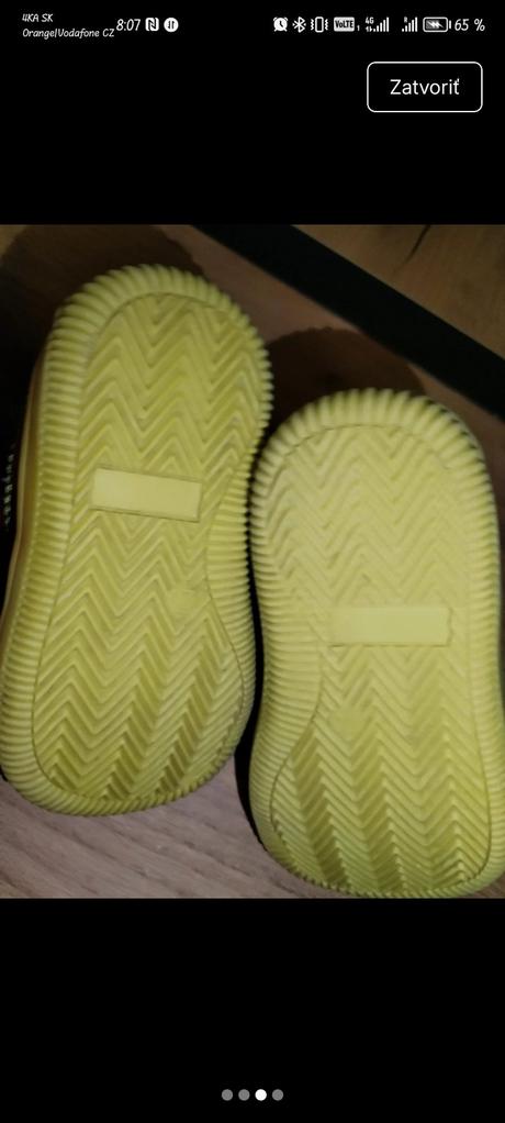 Nové kožené topánky protetika zateplené, protetika,20