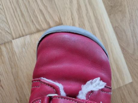 Beda zimne topanky, beda,33