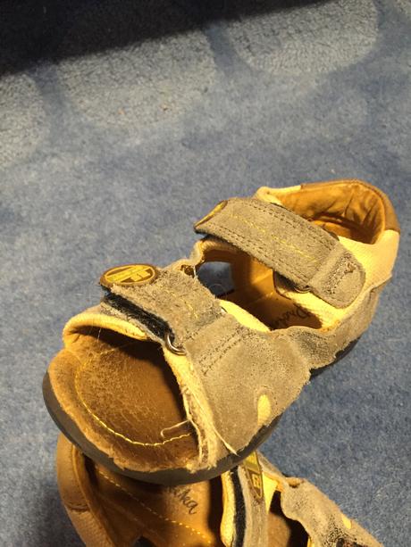 Sandálky protetika, protetika,27