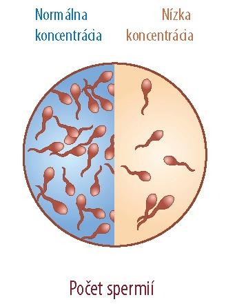 Spermiogram: Počet spermií v ejakuláte
