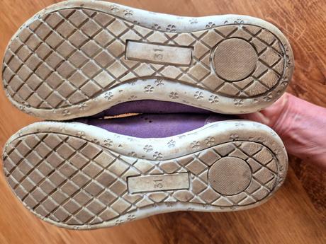 Balerinky protetika, protetika,31