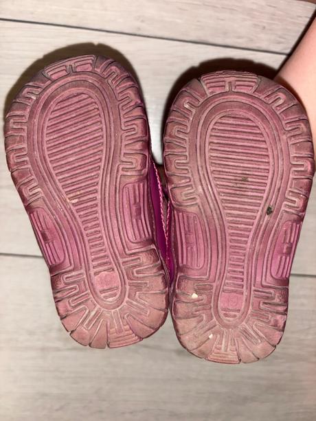 Zimné topánky, protetika,19