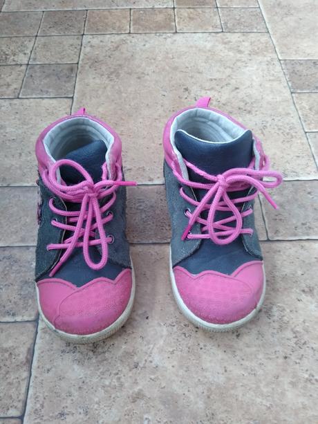 Topanky protetika, protetika,26