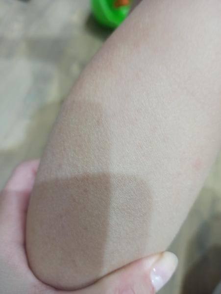 Aké červené fľaky má môj štvorročný syn na rukách?