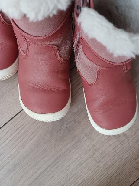 Protetika, zimná obuv už len veľ.25, protetika,23