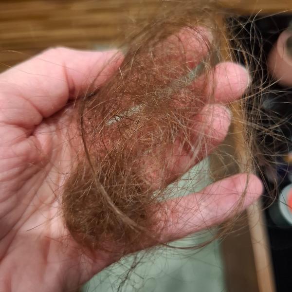 Vypadávanie vlasov u detí: Čo môže byť príčinou?