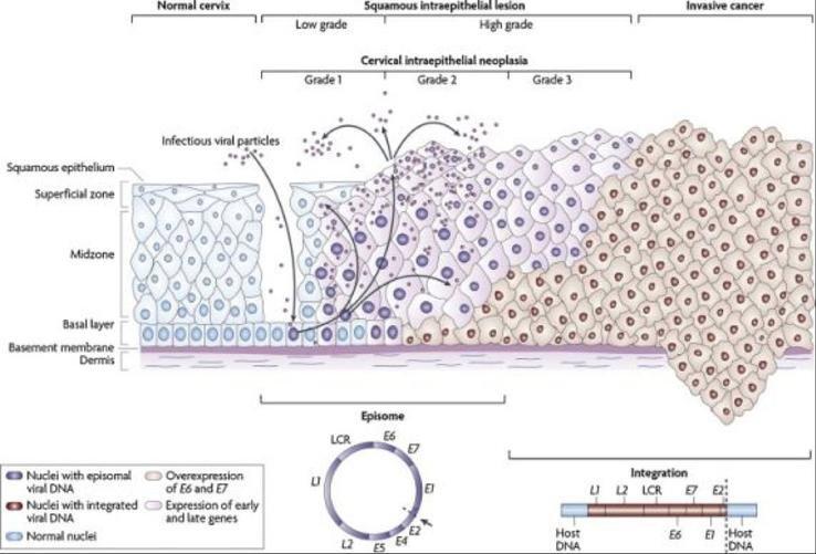 HPV vírus HPV vírus