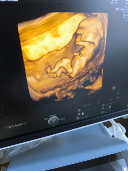 Je to chlapček alebo dievčatko?