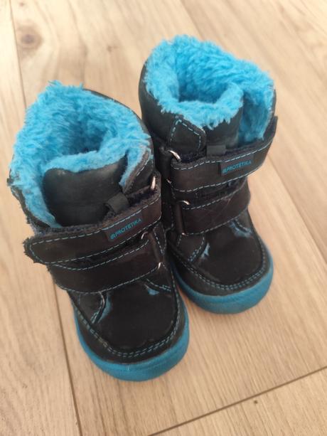 Čižmičky protetika, protetika,19