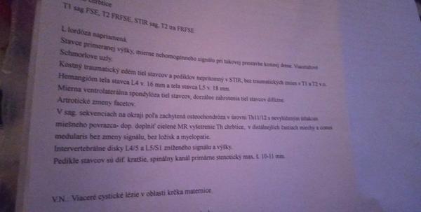 Aký je nález vo výsledkoch mojej magnetickej rezonancie?