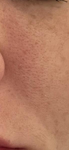 Ako sa starať o pleť po tridsiatke?