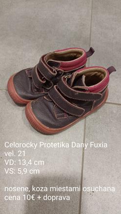 Barefoot celoročky protetika dany fuxia, veľ.21, protetika,21