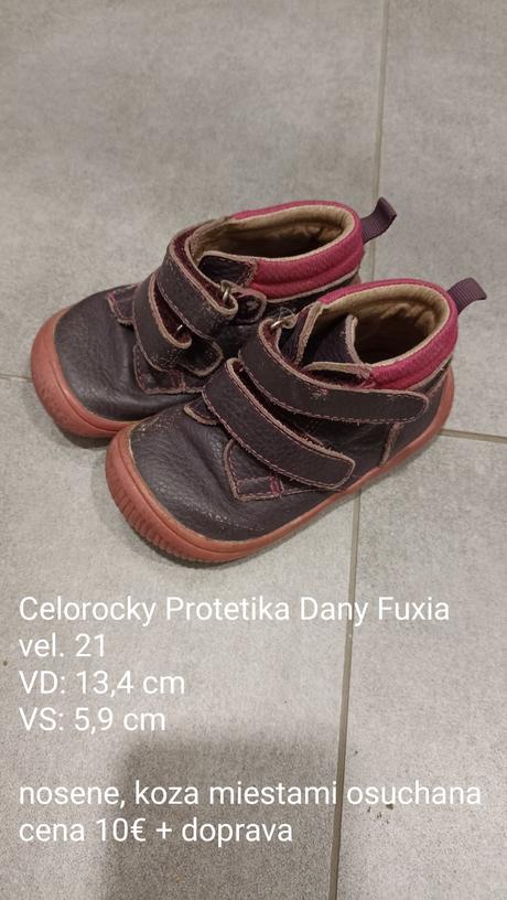 Barefoot celoročky protetika dany fuxia, veľ.21, protetika,21