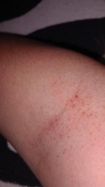 Čo to mám na pravej ruke?