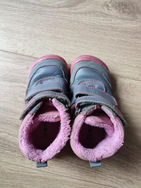 Protetika tyrel, protetika,25