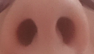 Už mesiac ma trápi tečúci nos a výtok z neho