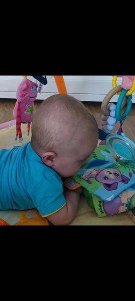 Cieva a šev na hlavičke. Je to v poriadku?