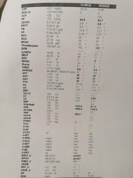 Znamená nárast týchto hodnôt pri Sjögrenovom syndróme niečo závažné?