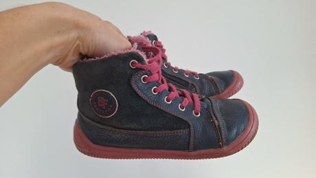 Protetika amis fuchsia, protetika,28