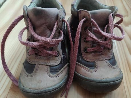 Dievcenske topanky protetika, protetika,22