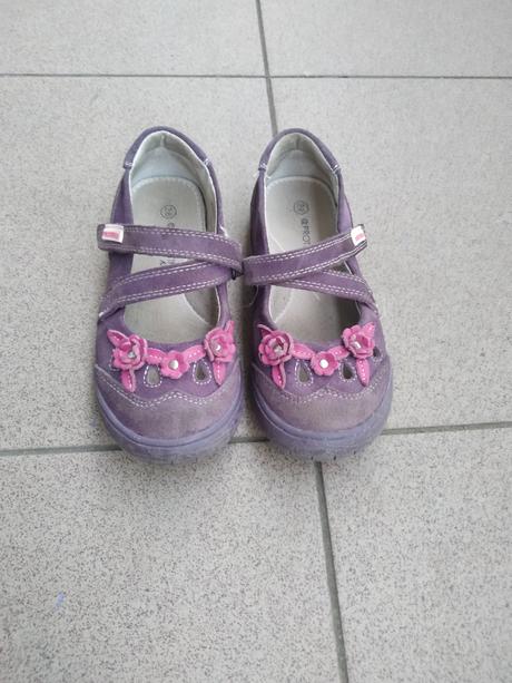 Milé topánočky protetika, protetika,28