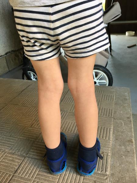 Sú nožičky môjho trojročného dieťaťa v poriadku?