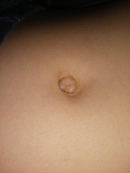 Je to pruh u dieťaťa?