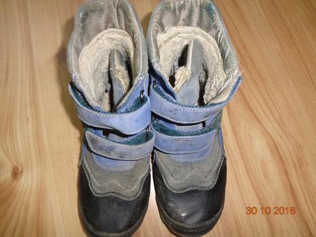 Topanky, protetika,34