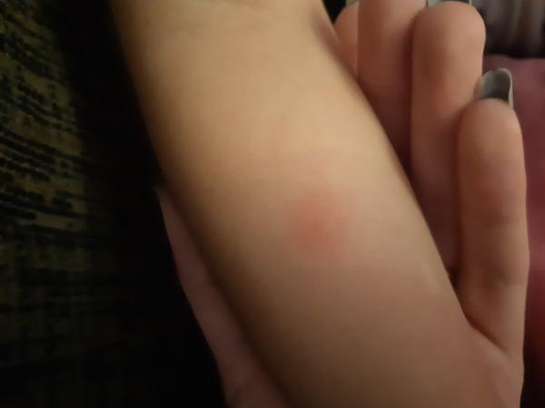 Má moja dcérka kiahne?