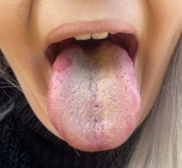 Z čoho môže byť takýto jazyk?