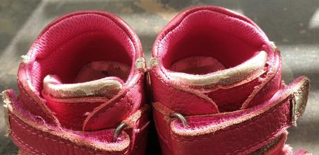 Protetika topánky, protetika,22