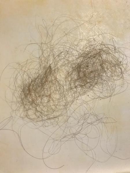 Trhanie vlasov 10-mesačnej dcérky.