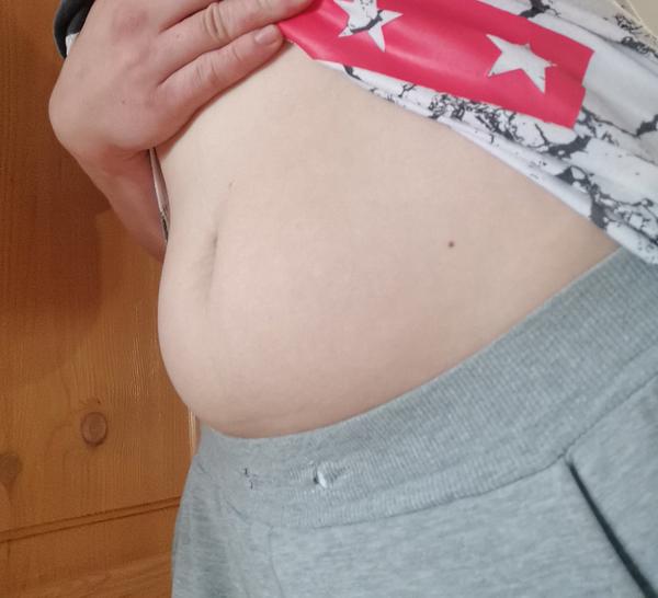 Je to tehotenské bruško?