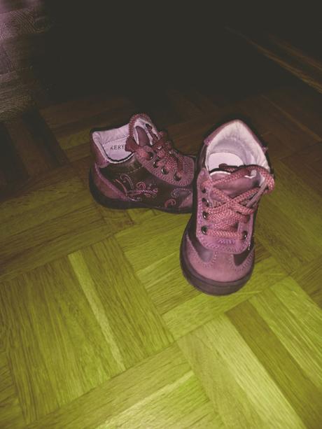 Topánocky protetika, protetika,20