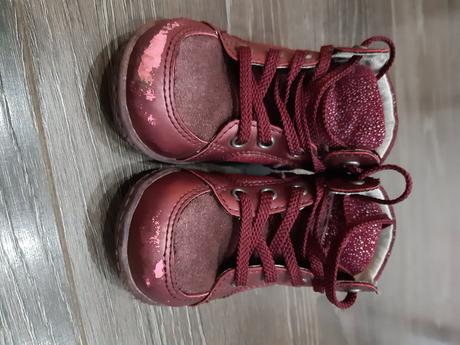 Topánky protetika 20, protetika,20