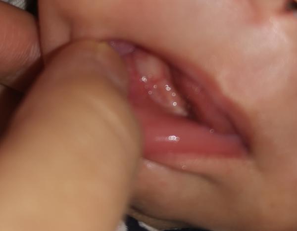 Uplakané 4-mesačné bábätko. Idú mu zúbky?