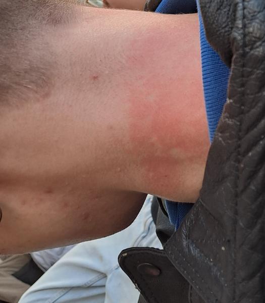 Čo môže spôsobovať tento problém?