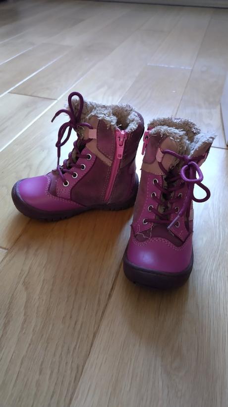 Čižmičky protetika, protetika,23