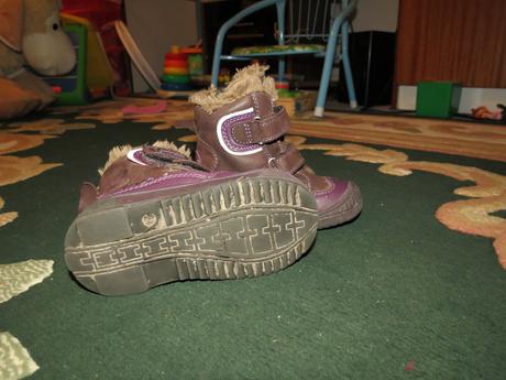 Zimné topánočky, protetika,21