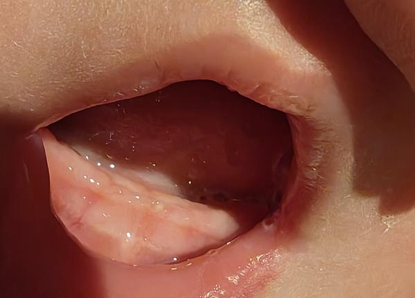 Je možné, aby 5-týždňovému bábätku rástli zuby?