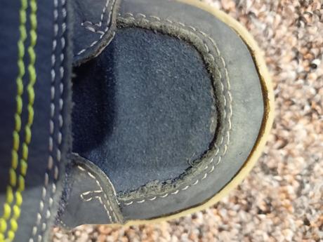 Topánočky protetika, protetika,22