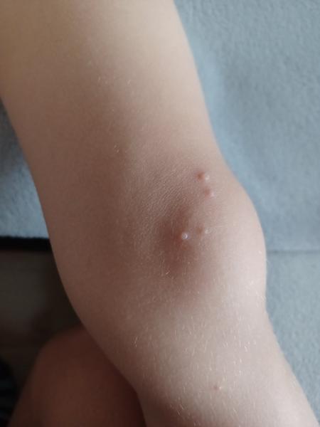 Sú toto ovčie kiahne?