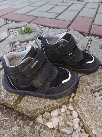 Prechodné protetika topánky, protetika,23