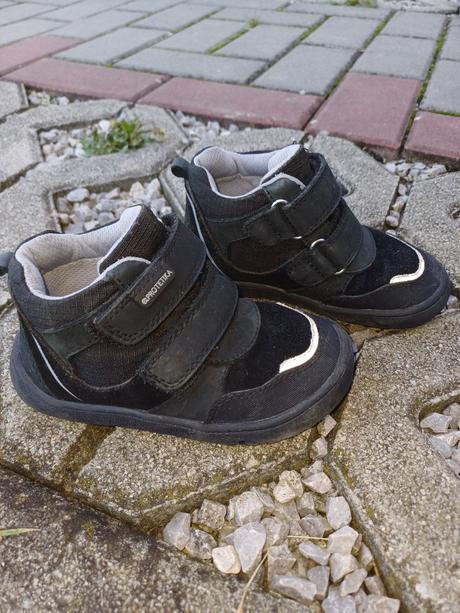 Prechodné protetika topánky, protetika,23